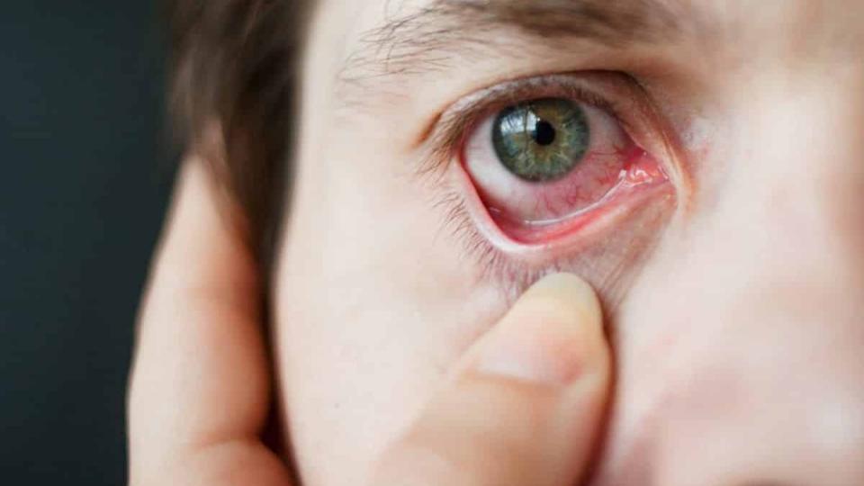 Ασθενοπία - η καταπόνηση των ματιών μας