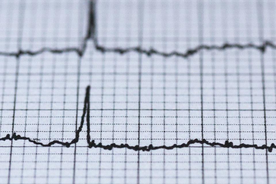 Αν κάνουμε καρδιογράφημα μπορούμε να προλάβουμε το έμφραγμα;